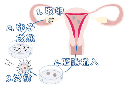生殖中心环境